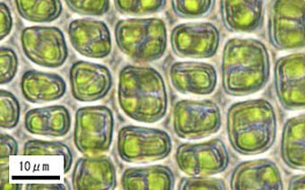 ハマキゴケの葉身細胞