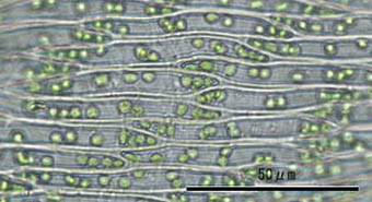 ハネヒツジゴケ葉身細胞