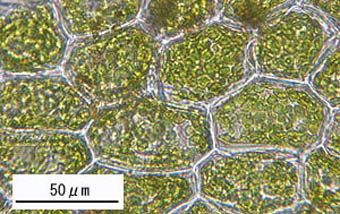 クモノスゴケの葉身細胞