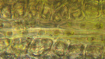 ネジクチゴケ中肋の表皮細胞