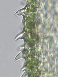 オオシノブゴケの葉身細胞のパピラ